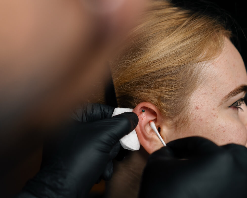 Ear Wax Removal Picture 2